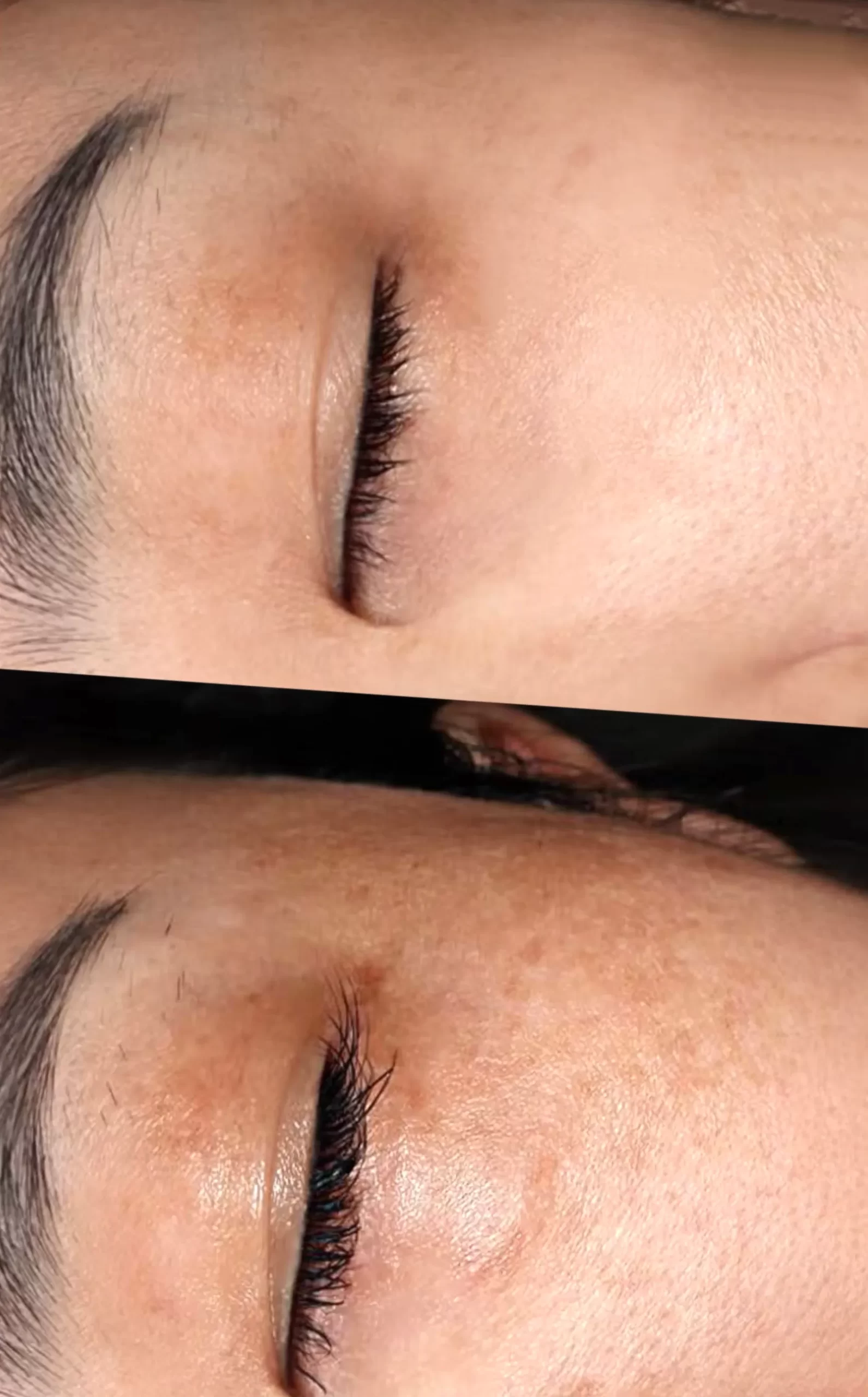 how long do skincare results take